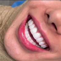 جشنواره نوروز کامپوزیت هرفک فقط۶ملیون ۵۰۰تومن