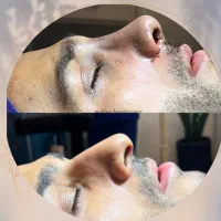 جراحی تخصصی بینی فقط با 36 میلیون تومان