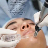 مدل برای فیشال