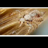 شپش|آرایشی، بهداشتی، درمانی|اصفهان, باغ فردوس|دیوار