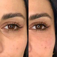 جشنواره  تزریق ژل  لب روسی وبوتاکس انزیم فیلر|خدمات آرایشگری و زیبایی|کرج, گلشهر|دیوار