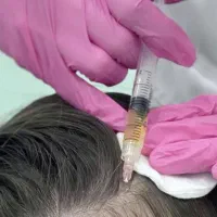 فیلر، بوتاکس، چربی، لیفت ودایرکت ابرو، مزو