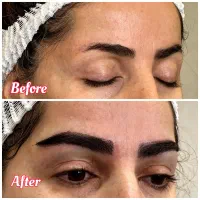 کاشت ابرو میکروکاشت طبیعی و دائمی