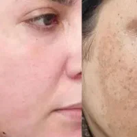 کلیه خدمات زیبائی هم خدمات هم آموزش