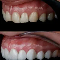 دندون پزشکی|خدمات آرایشگری و زیبایی|خرم‌آباد, |دیوار