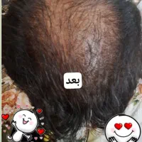 میخوای محصولی بهت معرفی کنم موههاتو تقویت کنه|آرایشی، بهداشتی، درمانی|ایلام, |دیوار