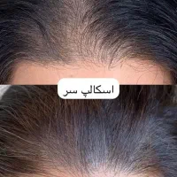 فیبروز و شیدینگ +(تخفیف ویژه)|خدمات آرایشگری و زیبایی|شیراز, پودنک|دیوار
