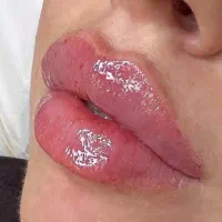 اف تزریق ژل روسی،عربی،خلیجی، بوتاکس|خدمات آرایشگری و زیبایی|شیراز, شهرک امیر کبیر|دیوار