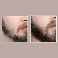 کوسه نباش|آرایشی، بهداشتی، درمانی|اصفهان, چرخاب|دیوار