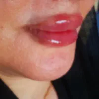 خدمات زیبایی