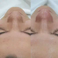 فیشال تخصصی درمانی در کلینیک زیبایی صبا|خدمات آرایشگری و زیبایی|تهران, عباس‌آباد|دیوار