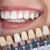 دندان سازی/پروتزمتحرک/دندان مصنوعی/اقساط چک صیادی