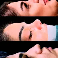 عمل جراحی بینی با ۵۰٪تخفیف ویژه فرصت محدود|خدمات آرایشگری و زیبایی|اصفهان, نقش جهان|دیوار