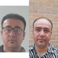 کاشت مو و ابرو از دم قسط ب روش شیراز در اصفهان