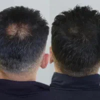 اصل المانی(کاملا تضمینی)+پرداخت درب منزل