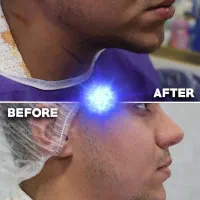 جشنواره ساکشن شکم ، پهلو و غبعب|خدمات آرایشگری و زیبایی|کرمانشاه, |دیوار