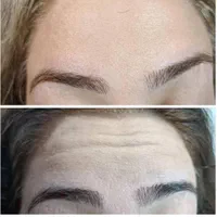 ژل لب و بوتاکس  مدلینگ پرسینگ چالگونه آموزش ژل|خدمات آرایشگری و زیبایی|اهواز, کیانپارس |دیوار