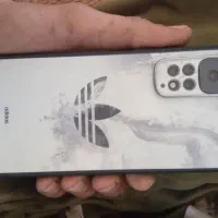 گوشی شیومی ردمی 11اس