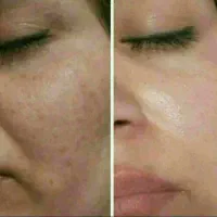 معجزه ضدلک روغن خارمریم
