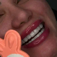 فقط با پنج میلیون کامپوزیت کن