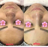 فیشال تخصصی و درمانی قم|خدمات آرایشگری و زیبایی|قم, زنبیل آباد|دیوار