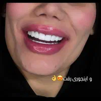 کامپوزیت دندان|خدمات آرایشگری و زیبایی|اهواز, نادری|دیوار