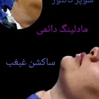 ژل .بوتاکس .هایفو.ساکشن غبغب وساکشن شکم وپهلو|خدمات آرایشگری و زیبایی|اصفهان, رکن الدوله غربی|دیوار