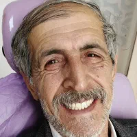 دندانسازی|خدمات آرایشگری و زیبایی|قم, لسانی|دیوار