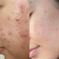 پک ضدجوش از برند آلمانی