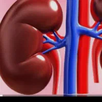 راهنمایی درموردپیوندکلیه