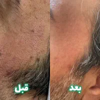 درمان تخصصی پوست و فشیال