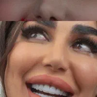 مرکز کامپوزیت ۷/۸۰۰تهرانprp جهت رویش مو برنداتریشی