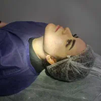 نیازمند مدل خوش چهره برای ساکشن غبغب و سوپرکانتور