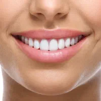 دندانپزشکی و دندانسازی نقد و اقساط