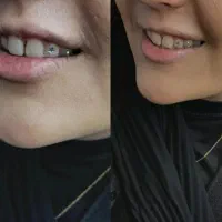 آموزش و اجرای پرسینگ