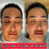 جشنواره تخفیف ویژه فیلربوتاکس انزیم وقت فوری|خدمات آرایشگری و زیبایی|کرج, گوهردشت|دیوار