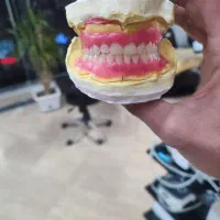 ساخت دندان از دست رفته