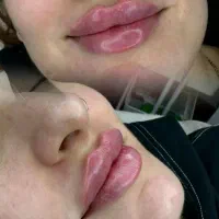 ژل 990 بوتاکس (مزوتراپی مو و پوست 890) پی ارپی