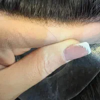 پروتز مو|خدمات آرایشگری و زیبایی|دزفول, |دیوار