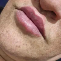 ژل وبوتاکس|خدمات آرایشگری و زیبایی|مشهد, ایثارگران|دیوار