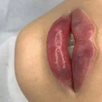تزریق ژل، بوتاکس، لیزر