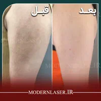 درمان کامل انواع لک پوستی توسط پزشک|خدمات آرایشگری و زیبایی|اصفهان, سعادت‌آباد|دیوار