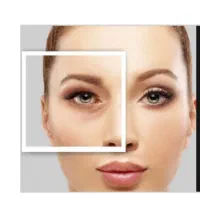 انجام تخصصی بلفاروپلاستی( جراحی پف پلک)