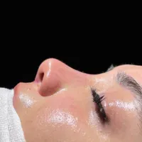 عمل جراحی بینی با تخفیف ویژه در فستیوال تابستانه|خدمات آرایشگری و زیبایی|تهران, فلسطین (میدان انقلاب)|دیوار