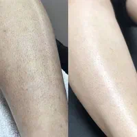 مطب زیبایی پوست مو لیزر الکساندرایت|خدمات آرایشگری و زیبایی|مشکیندشت, |دیوار