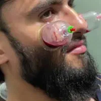 خدمات پرستاری درمنزل حجامت زالو سرم تراپی ماساژ تر