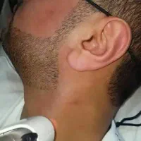 راهنمایی لیزر