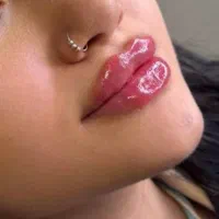 خدمات ژل و بوتاکس ، مزوتراپی سر و صورت|خدمات آرایشگری و زیبایی|شاهینشهر, فردوسی|دیوار