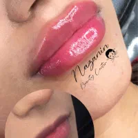 بوتاکس، فیلر و خدمات پیرسینگ|خدمات آرایشگری و زیبایی|رشت, خواهر امام|دیوار