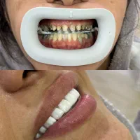 جشنواره دندانپزشکی (تمامی خدمات)|خدمات آرایشگری و زیبایی|اصفهان, لنبان|دیوار